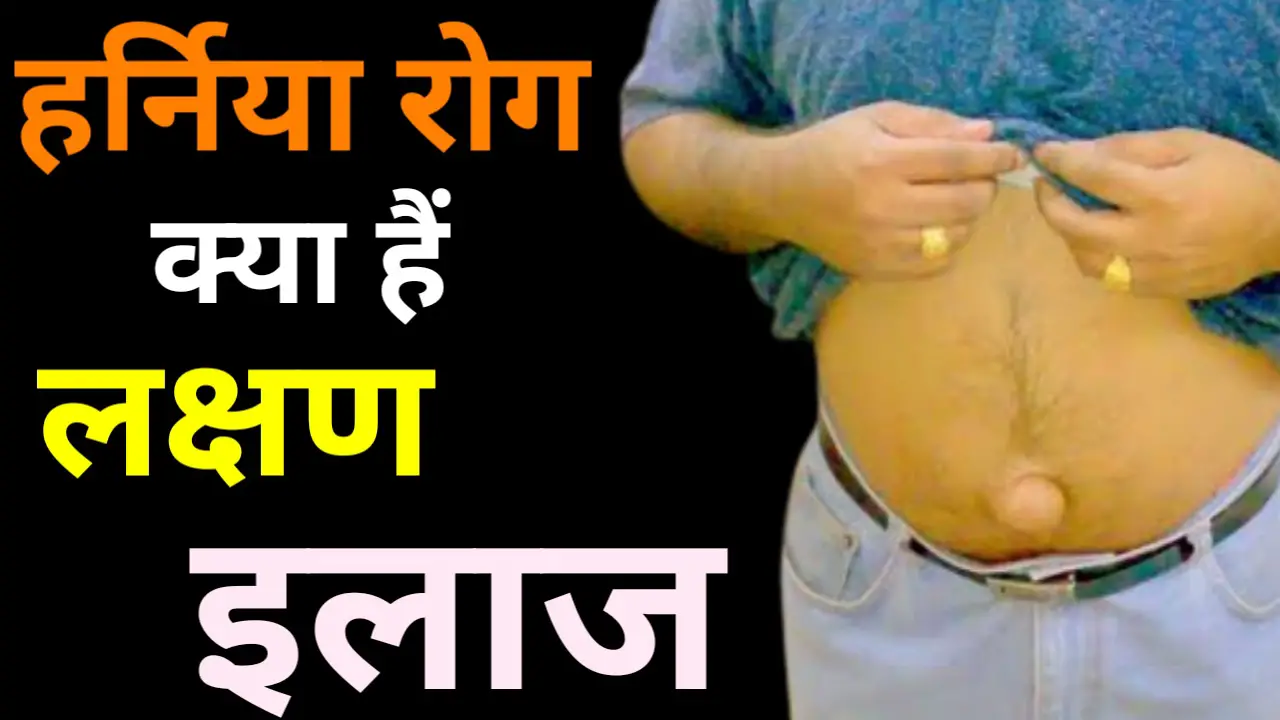 हर्निया रोग क्या है in Hindi लक्षण, प्रकार, कारण और उपचार के तरीके